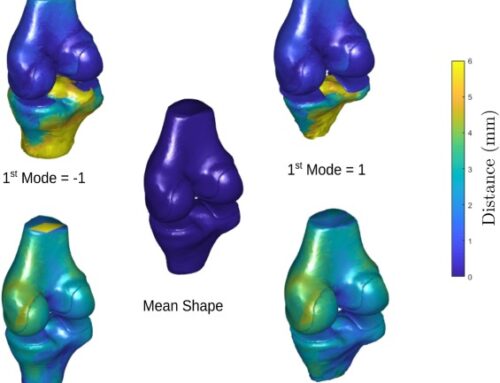 Regularized Multi-Structural Shape Modeling of the Knee Complex based on Deep Functional Maps