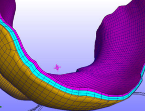 Personalized Knee Geometry Modelling based on Multi-Atlas Segmentation and Mesh Refinement