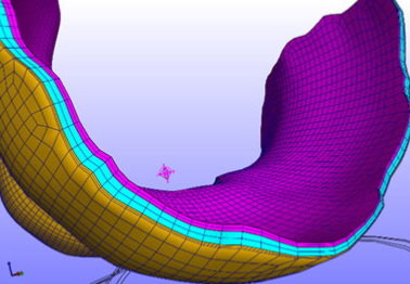 Personalized Knee Geometry Modelling based on Multi-Atlas Segmentation and Mesh Refinement